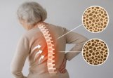 Остеопороз у пожилых людей: профилактика и безопасная среда