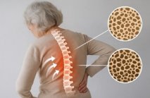 Остеопороз у пожилых людей: профилактика и безопасная среда